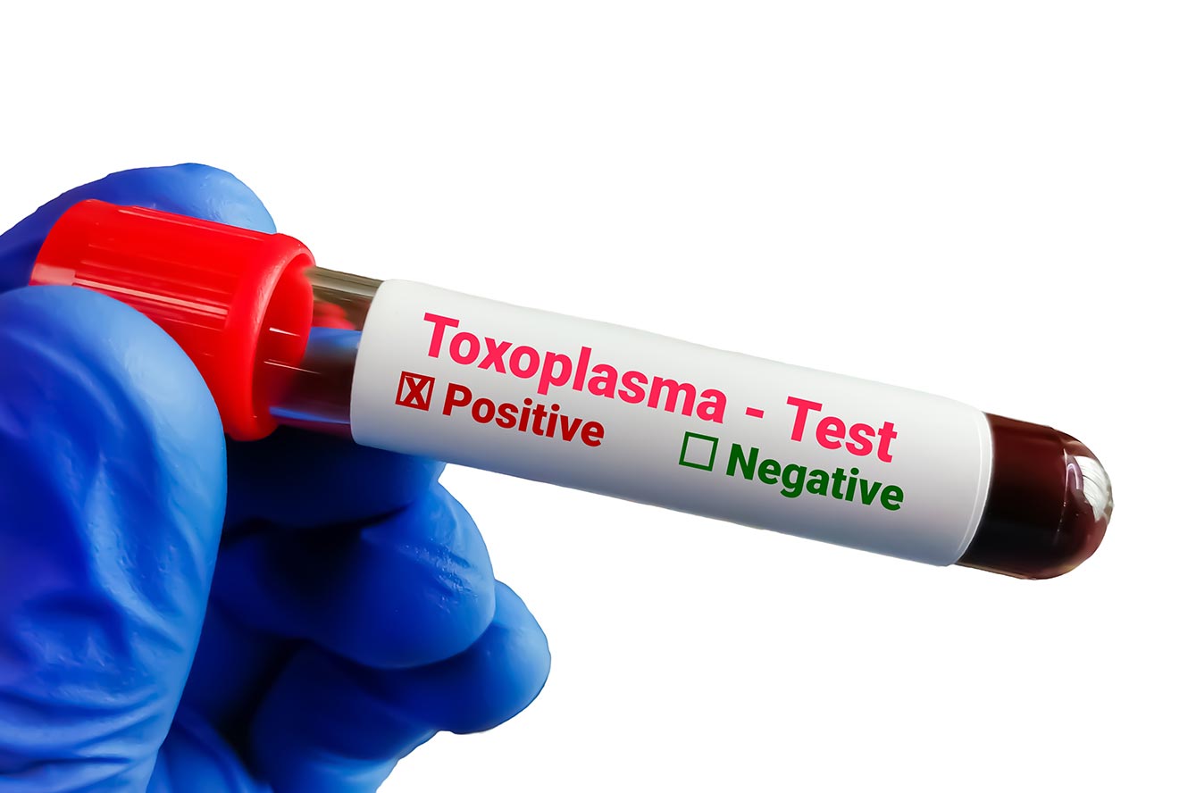 Qu’est-ce que la toxoplasmose ?
