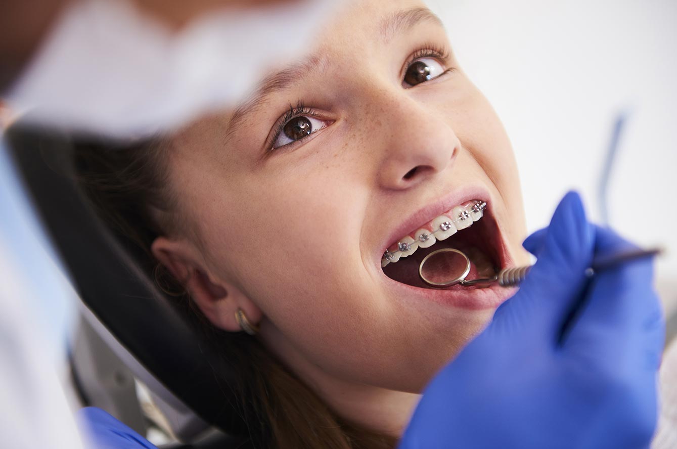 Orthodontie : les étapes du traitement et leur impact sur la confiance en soi