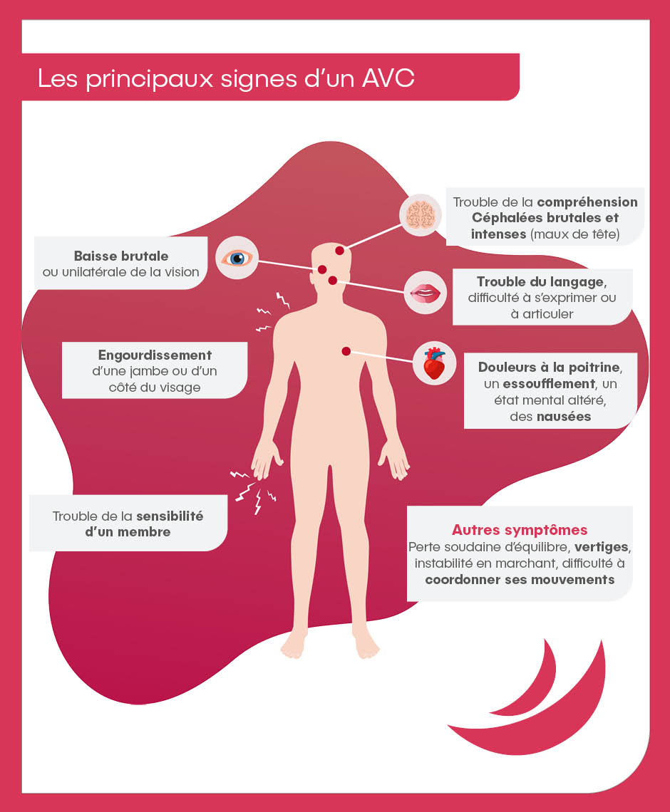 Les signes d'un AVC