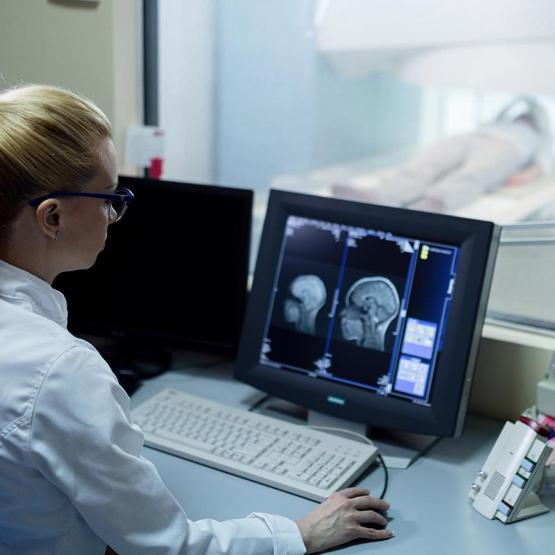 sclerose en plaques SEP maladie